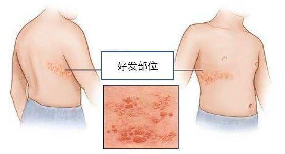 「蛇腰纏一圈」會致命嗎？