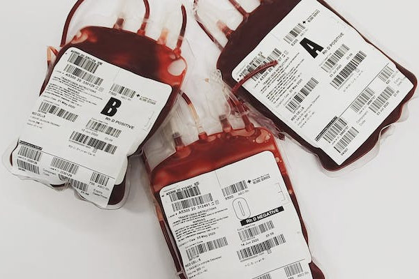 為什麼血型檢測不能做親子鑒定？