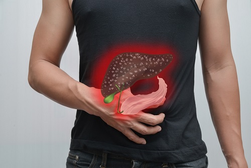 癌的啟示：胃癌症狀與消化不良相似 易被忽視