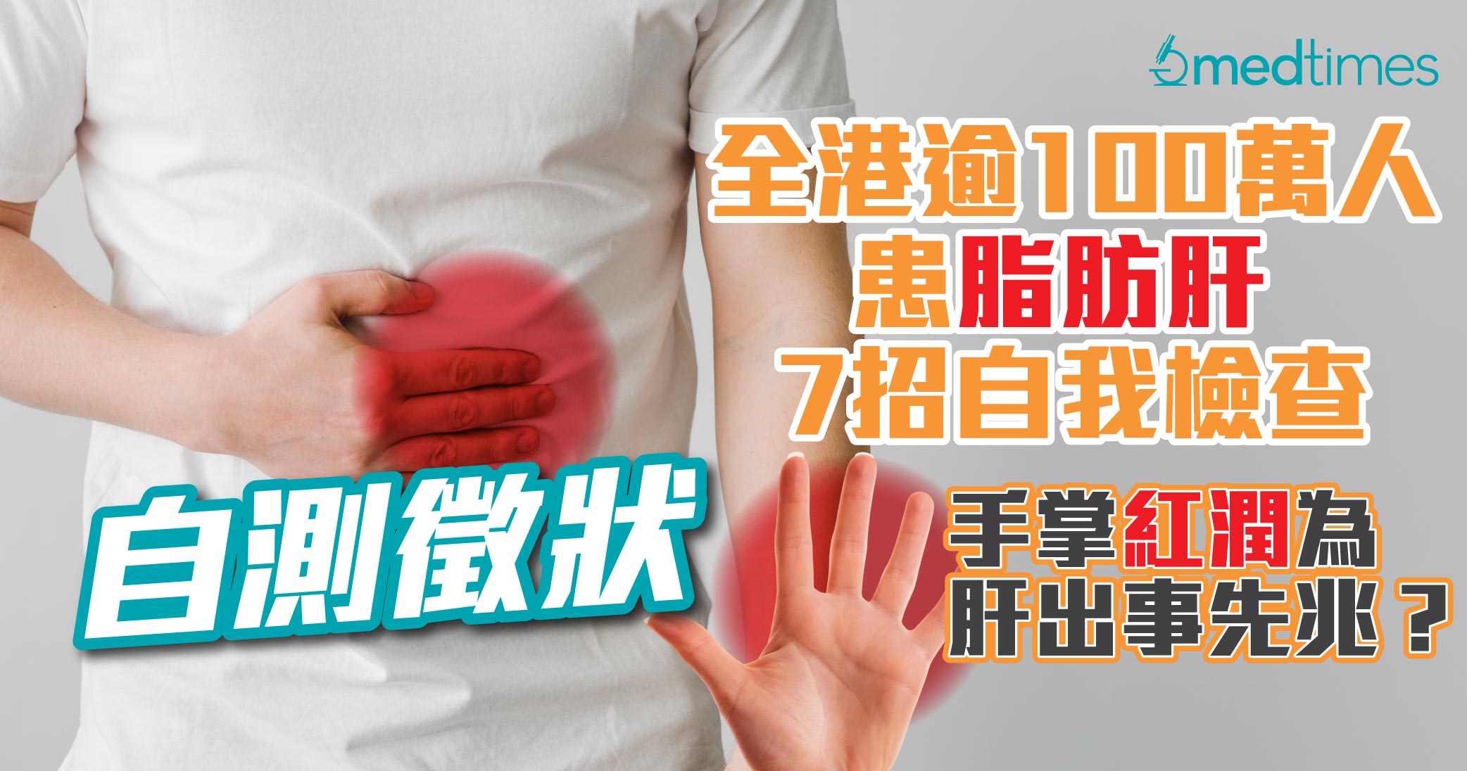 【自測徵狀】全港逾100萬人患脂肪肝 7招自我檢查 手掌紅潤為肝出事先兆？